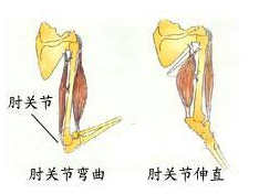 肘关节脱位复位方法介绍