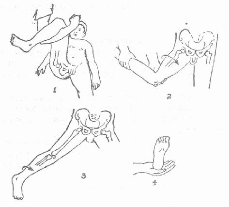 骨折病人功能锻炼的方法（下肢骨折）