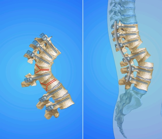 左振素：强直性脊柱炎辨治经验