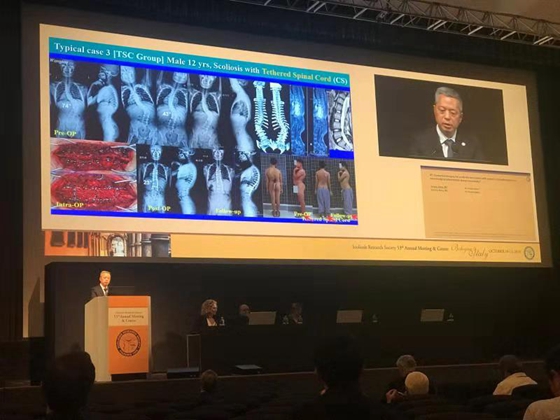 张宏其教授获邀两次在第53届国际脊柱侧凸研究学会年会上大会报告脊柱畸形治疗最新成果